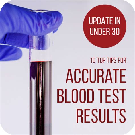 How To Get the Most Accurate Blood Test Results.